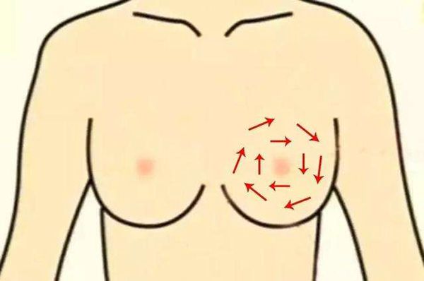 乳腺增生的预防